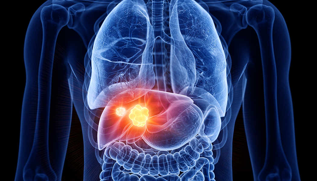 Liver Disorders